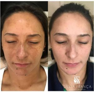 WhatsApp Image 2024-04-04 at 17.22.37 (2)