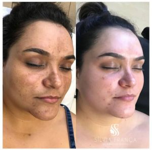 WhatsApp Image 2024-04-04 at 17.22.37