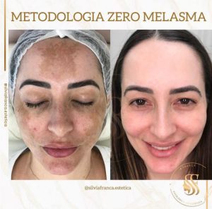 WhatsApp Image 2024-04-04 at 17.22.41 (2)