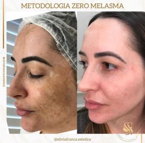 WhatsApp Image 2024-04-04 at 17.22.41