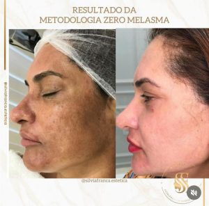 WhatsApp Image 2024-04-04 at 17.22.42 (1)