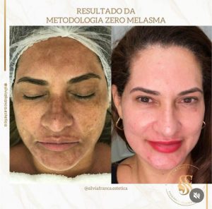 WhatsApp Image 2024-04-04 at 17.22.43