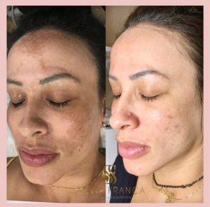 WhatsApp Image 2024-04-04 at 17.32.11 (1)