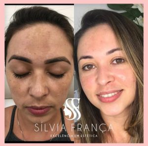 WhatsApp Image 2024-04-04 at 17.32.12 (1)